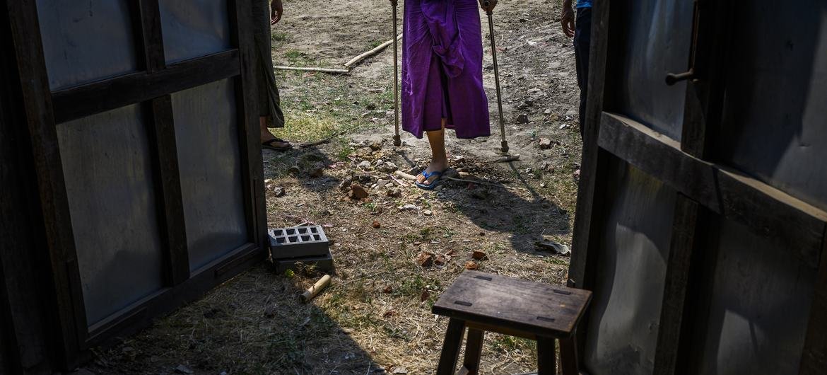 A child who lost his left leg after accidentally stepping on a landmine in his family's paddy fields in central Myanmar. A child who lost his left leg after accidentally stepping on a landmine in his family's paddy fields in central Myanmar.